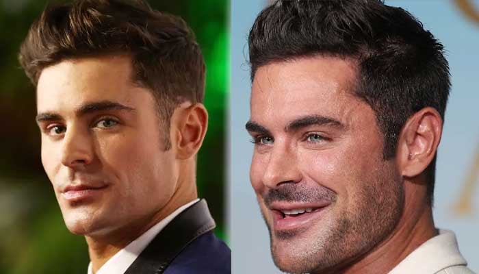 Zac Efron Face Accident: The Shocking Truth Behind His Injury