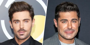 Zac Efron Face Accident: The Shocking Truth Behind His Injury