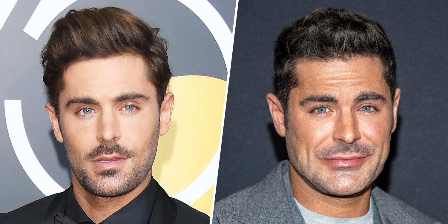 Zac Efron Face Accident: The Shocking Truth Behind His Injury