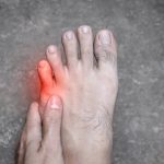 Why Does My Pinky Toe Hurt? Symptoms and Treatment 2026