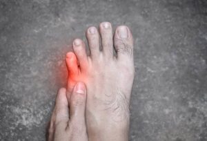 Why Does My Pinky Toe Hurt? Symptoms and Treatment 2026