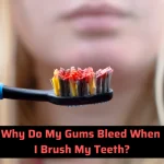 Why Do My Gums Bleed When I Brush My Teeth? Facts 2026