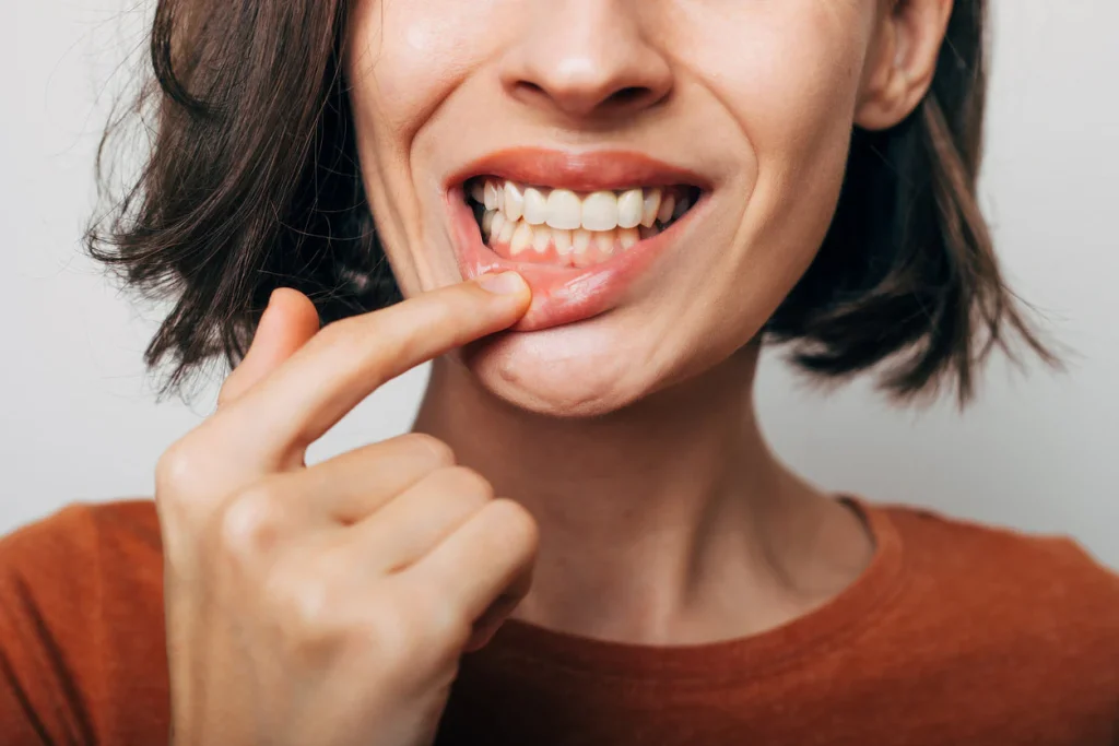 Why Do My Gums Hurt in One Spot? Is It Serious? 2026