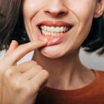 Why Do My Gums Hurt in One Spot? Is It Serious? 2026