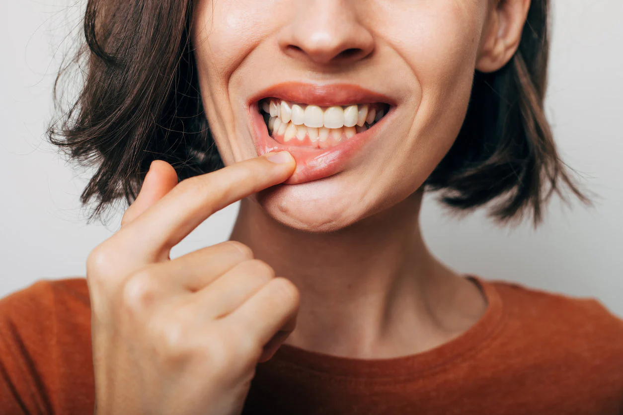 Why Do My Gums Hurt in One Spot? Is It Serious? 2026