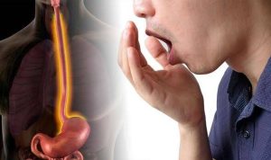 Why Am I Burping Eggs? Fast Relief Tips 2026