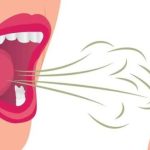 Why Does My Breath Smell Like Poop? Causes & Fixes 2026