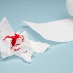 Why Do Hemorrhoids Bleed? Relief & Prevention 2026