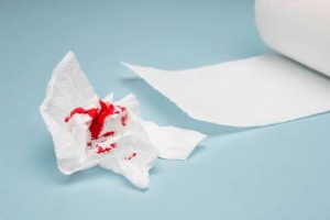 Why Do Hemorrhoids Bleed? Relief & Prevention 2026