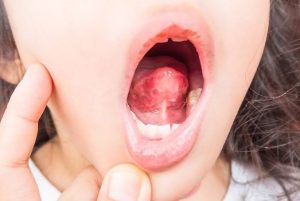 Why Is My Tongue Sore? Causes, Fixes & When to Worry 2026
