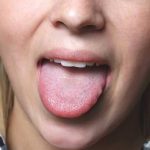 Why Is My Tongue Orange? Should You Worry? 2026