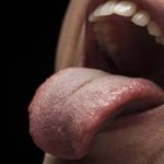 Why Does My Tongue Hurt on the Side? What It Means 2026