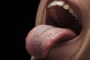Why Does My Tongue Hurt on the Side? What It Means 2026