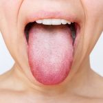 Why My Tongue White? Causes, Symptoms & Care 2026