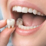 Why Does My Tooth Filling Hurt After Months? Is It Normal? 2026