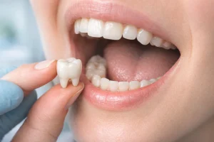 Why Does My Tooth Filling Hurt After Months? Is It Normal? 2026