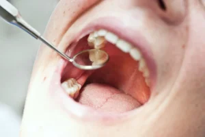 Why Does Tooth Pain Come and Go? Causes & Fixes 2026