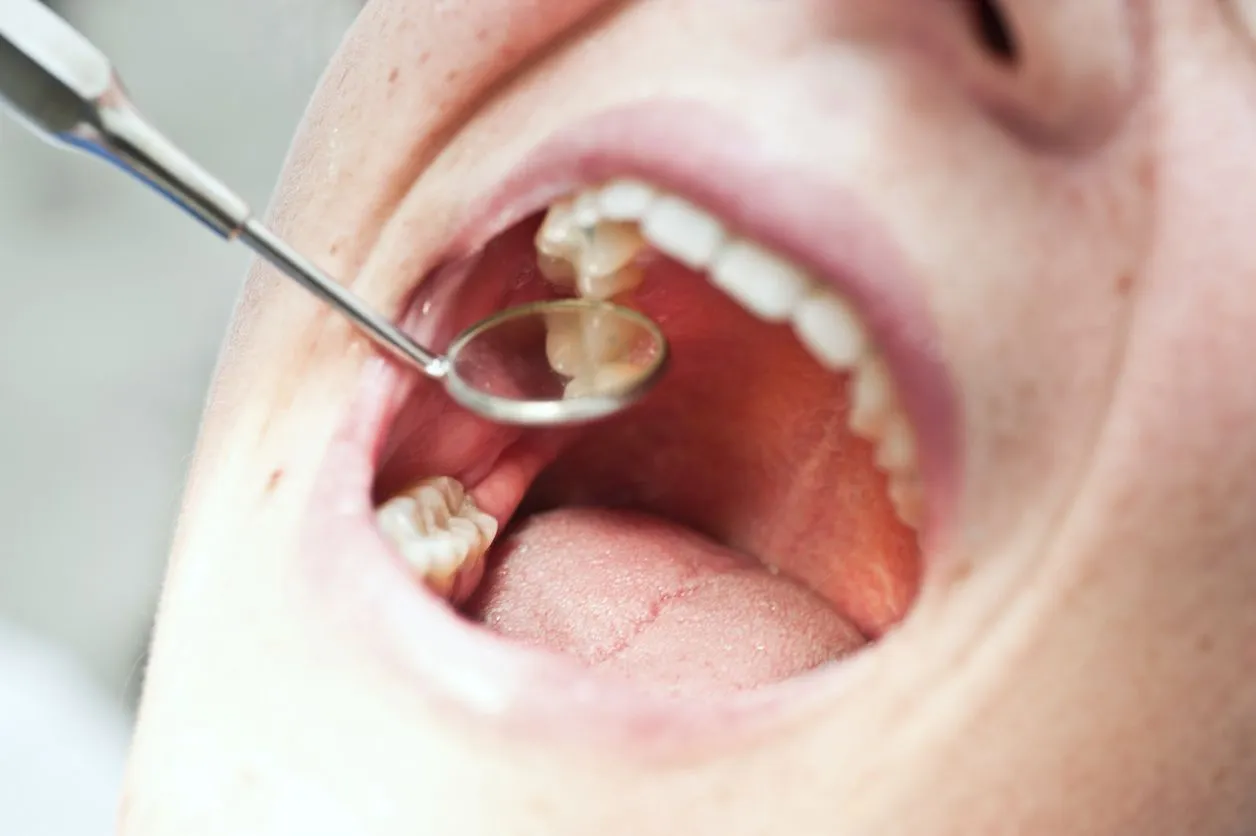 Why Does Tooth Pain Come and Go? Causes & Fixes 2026