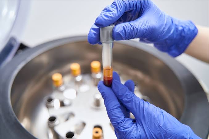 Why No Caffeine After PRP? What You Need to Know 2026