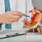 Why Would I Be Referred to a Gastroenterologist? Real Reason 2026