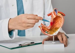 Why Would I Be Referred to a Gastroenterologist? Real Reason 2026