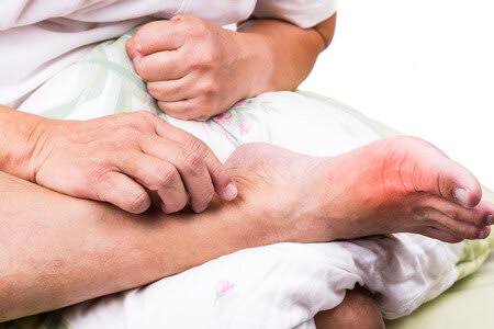Why Are the Bottoms of My Feet Red? Causes Explained 2026