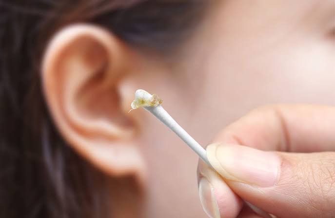 Why Do We Have Ear Wax? The Surprising Reason 2026