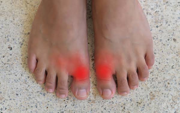Why Is My Big Toe Hurting? Causes, Symptoms & Relief 2026